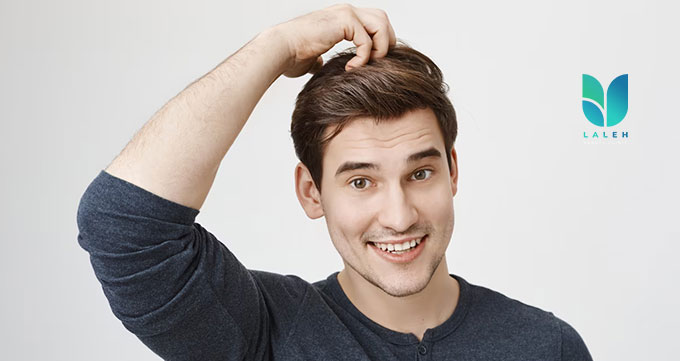 فصل کاشت مو