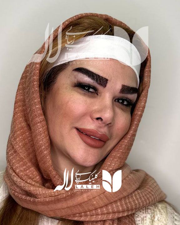 کاشت ابرو یا تتو ابرو، کدام روش را انتخاب کنیم ؟