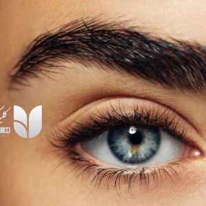 نکروز در کاشت ابرو چیست و چرا رخ می دهد ؟