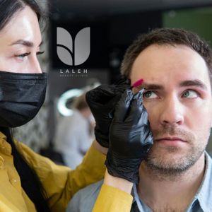 کاشت ابرو برای آقایان