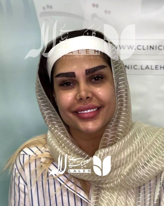 کاشت ابرو یا تتو ابرو، کدام روش را انتخاب کنیم ؟