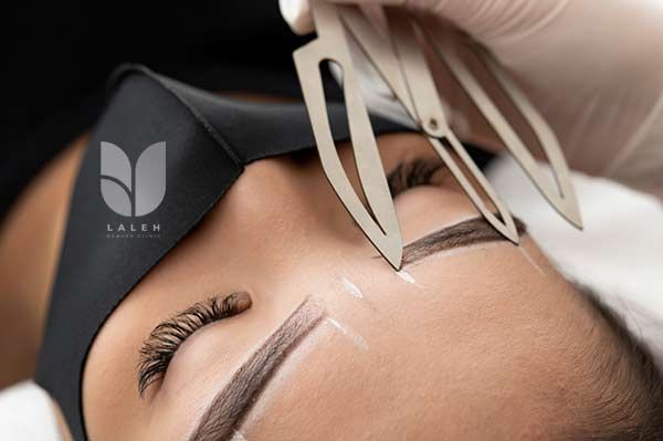 روش کاشت ابروی طبیعی