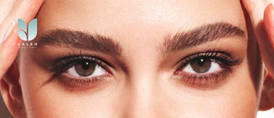 نمونه کاشت ابرو