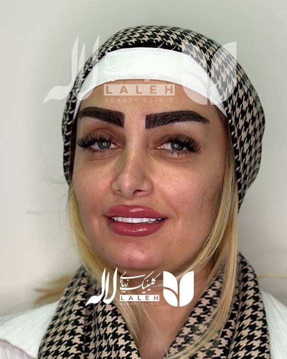 کاشت ابرو یا تتو ابرو، کدام روش را انتخاب کنیم ؟