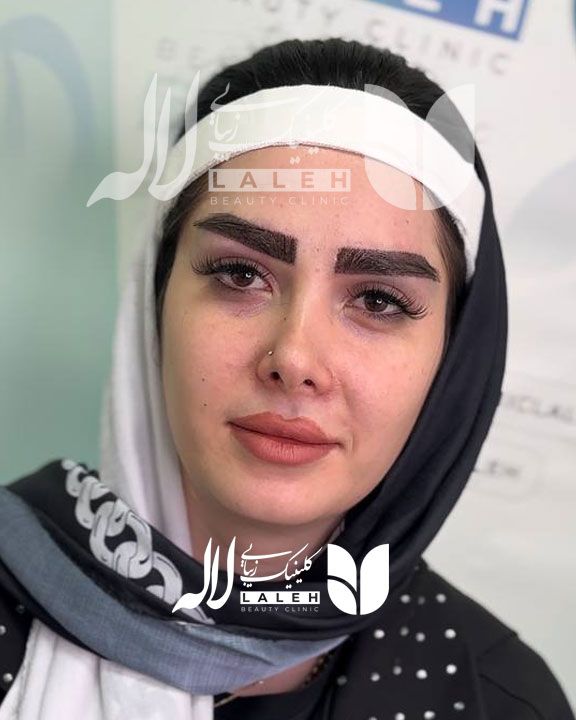 کاشت ابرو یا تتو ابرو، کدام روش را انتخاب کنیم ؟