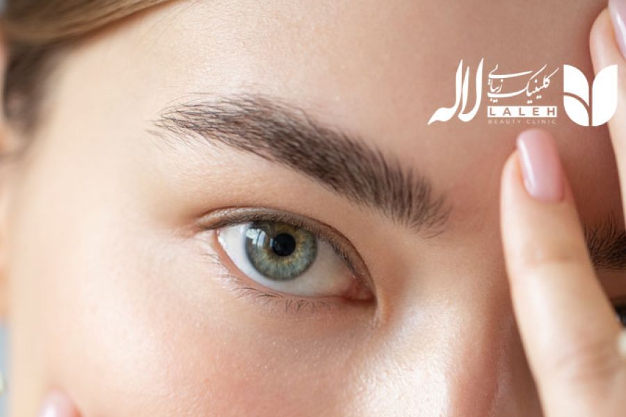 مراقبت های قبل از کاشت ابرو