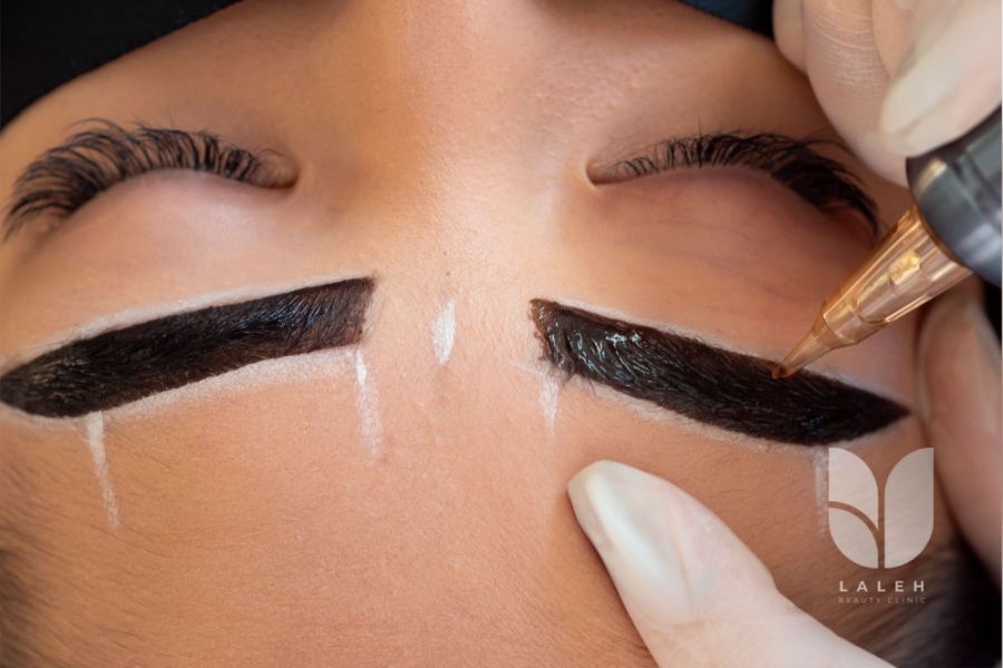 کدام روش کاشت ابرو بهترین انتخاب است؟