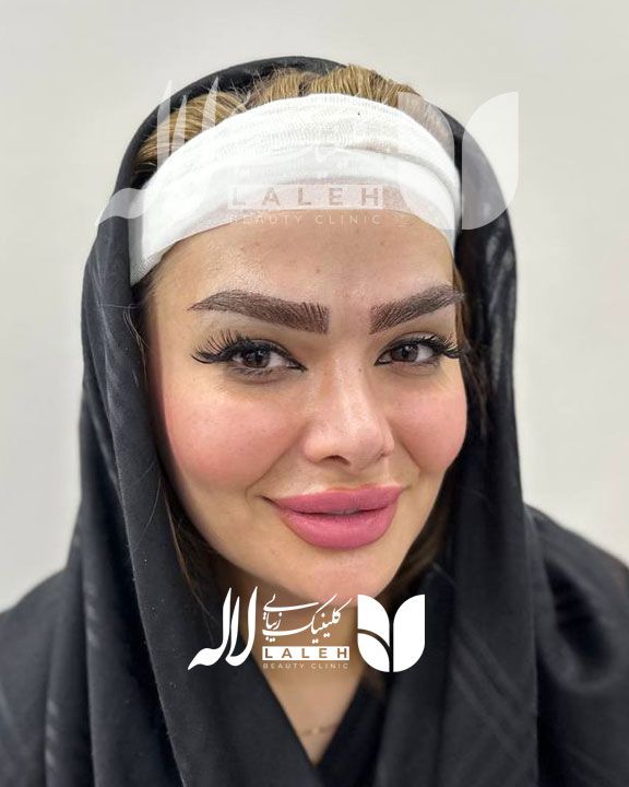 کاشت ابرو یا تتو ابرو، کدام روش را انتخاب کنیم ؟