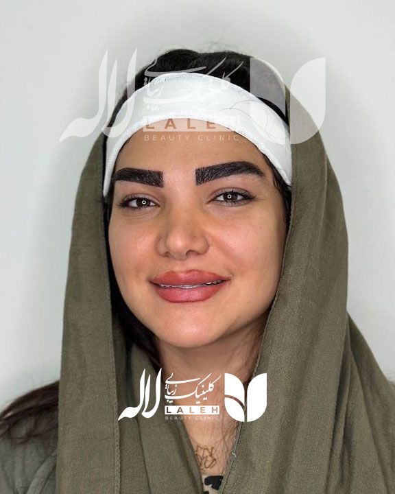 کاشت ابرو یا تتو ابرو، کدام روش را انتخاب کنیم ؟