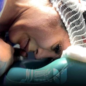 فیلم کاشت ابرو کامل + هزینه کاشت ابرو سال 1403