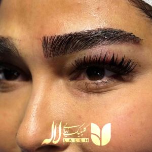 کاشت ابرو در زمان بارداری