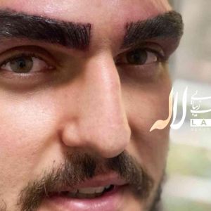 آیا آقایان هم می توانند کاشت ابرو انجام دهند ؟