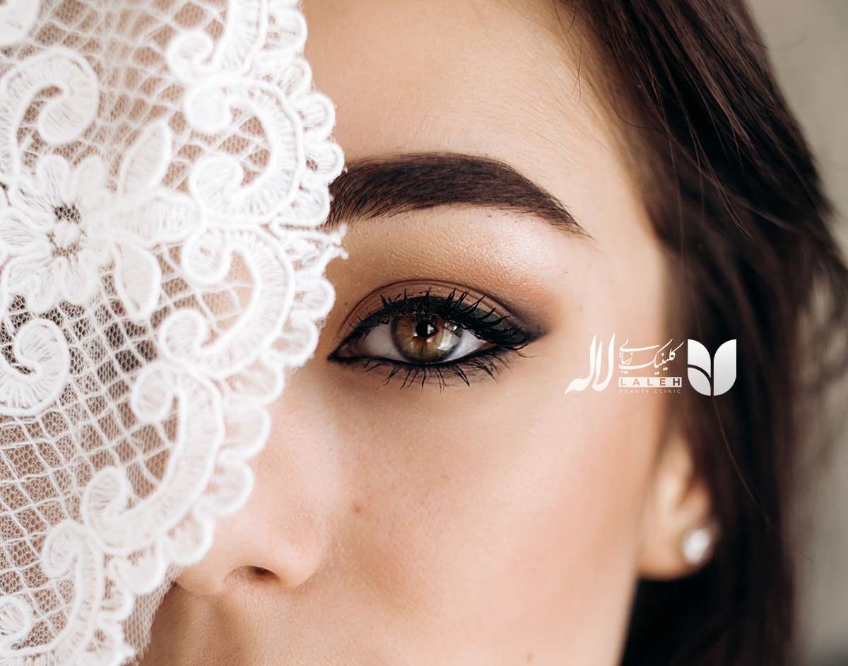 هزینه کاشت ابرو